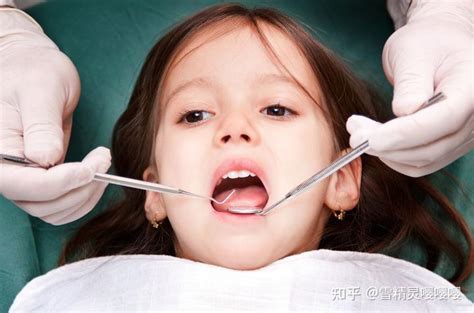 儿童智齿需要治疗吗