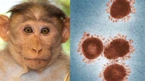 出现女性猴痘感染者意味着什么情况