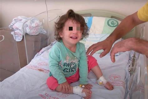 土耳其2岁女童被蛇咬了反咬蛇