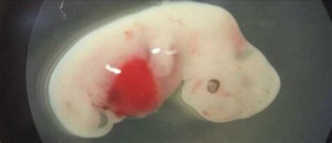 多久确认胚胎存活
