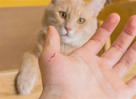 女人梦到被猫咬手出血