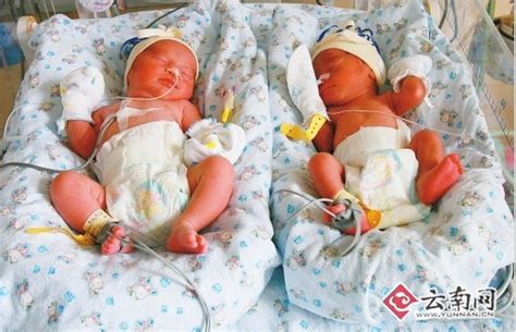 女子产下双胞胎一个不是亲生的