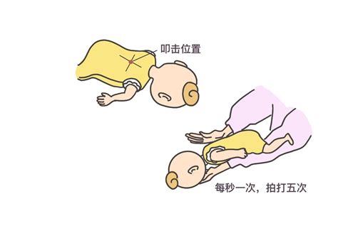 婴儿海姆立克急救法操作流程图片