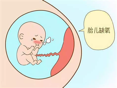 孕二十八周胎儿缺氧征兆