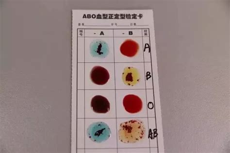 安徽本地血液检测卡是什么