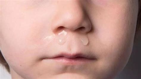 宝宝流鼻涕有哪些原因