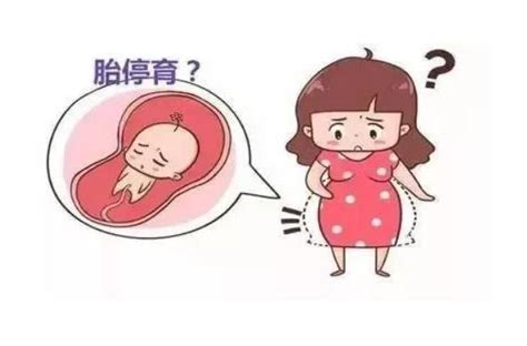 怀孕几个月容易胎停