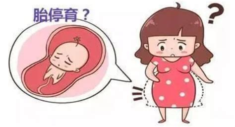 怀孕17周胎停是什么原因