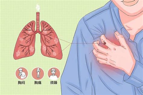 急性胸痛的处理原则是什么