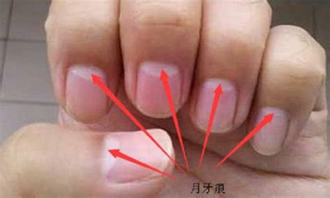 手指甲里的月牙代表什么