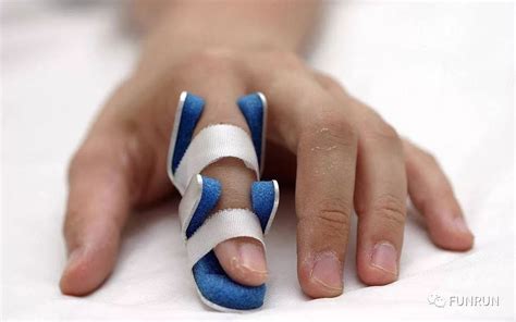 挫伤手指最快恢复方法