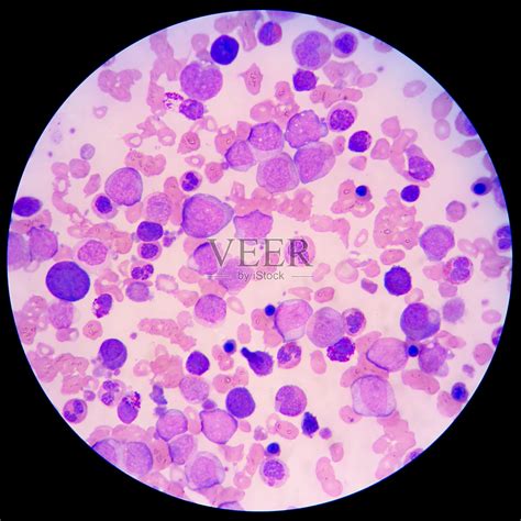 显微镜化验血液