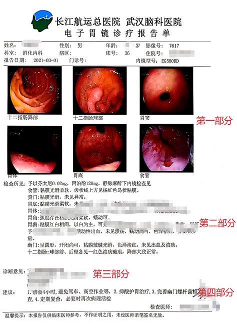 济宁胃镜图片报告单
