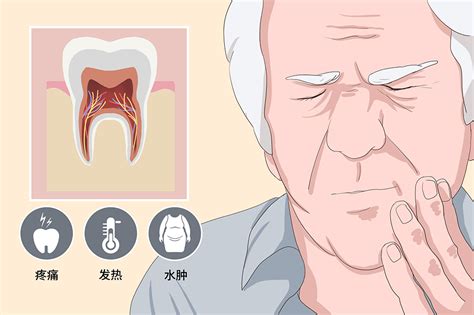 牙髓炎8级疼痛