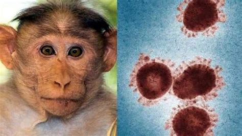 猴痘病毒不传染女性吗