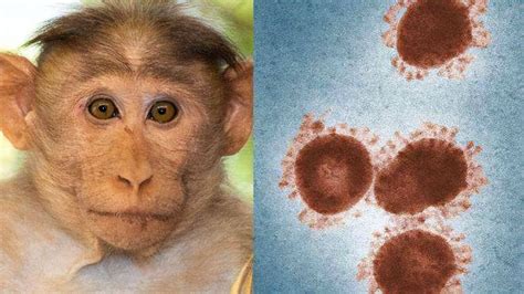 猴痘病毒会不会传染到中国
