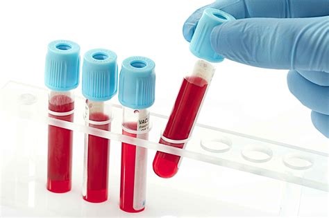 疫情双抗检测需要抽血吗