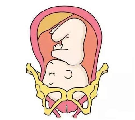 胎儿入盆动态示意图