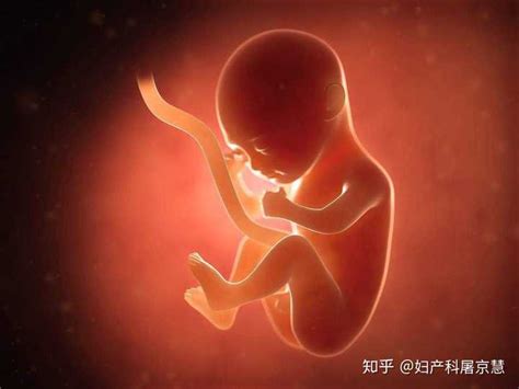 胎儿几个月容易脐带绕颈