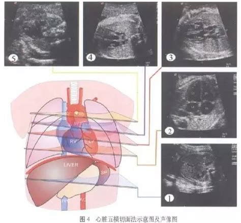胎儿心脏畸形孕妇表现