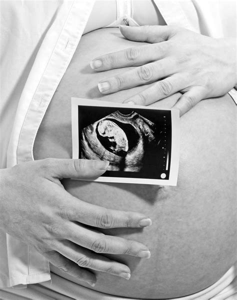 胎儿第几周容易畸形