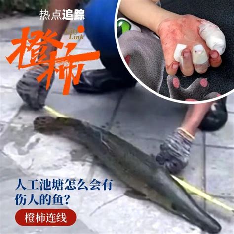 长江游泳被鱼咬伤