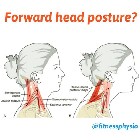the position of your head