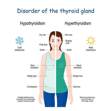thyroiddiseases
